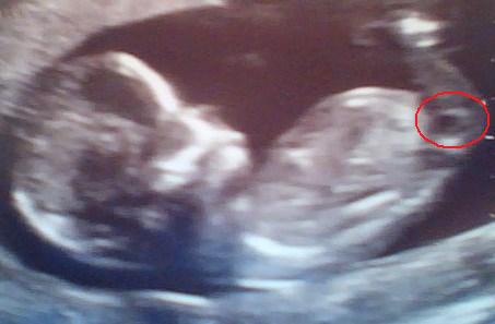 Name:  13week.jpg
Views: 872
Size:  22.4 KB