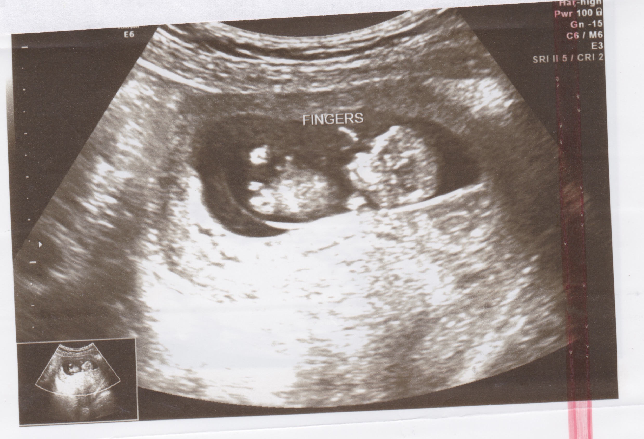 Name:  scan1.jpeg
Views: 143
Size:  815.1 KB
