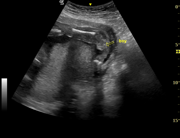 Name:  Baby 2015 2.jpg
Views: 1179
Size:  116.8 KB