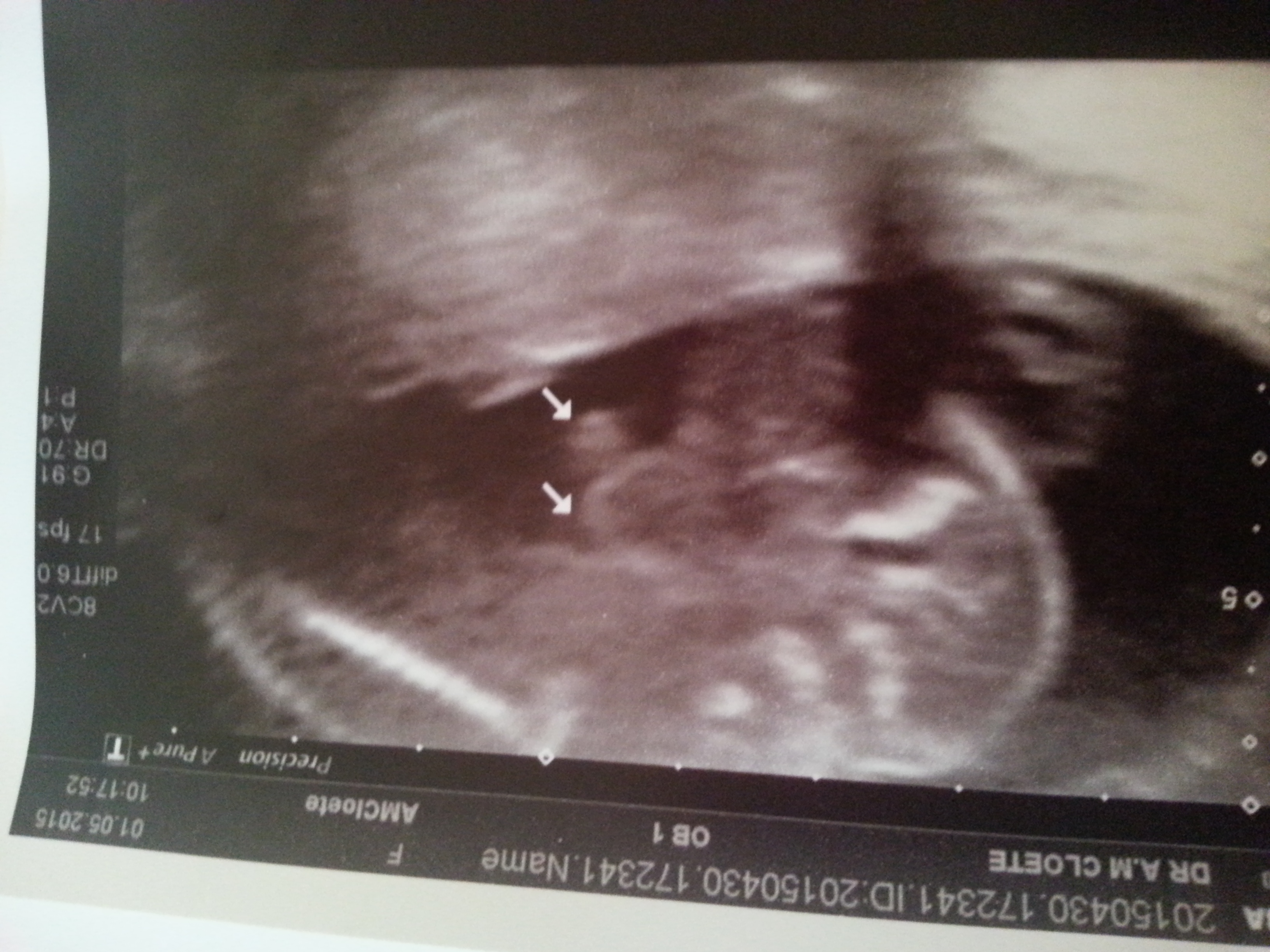 Name:  boy2.jpg
Views: 2363
Size:  1.76 MB