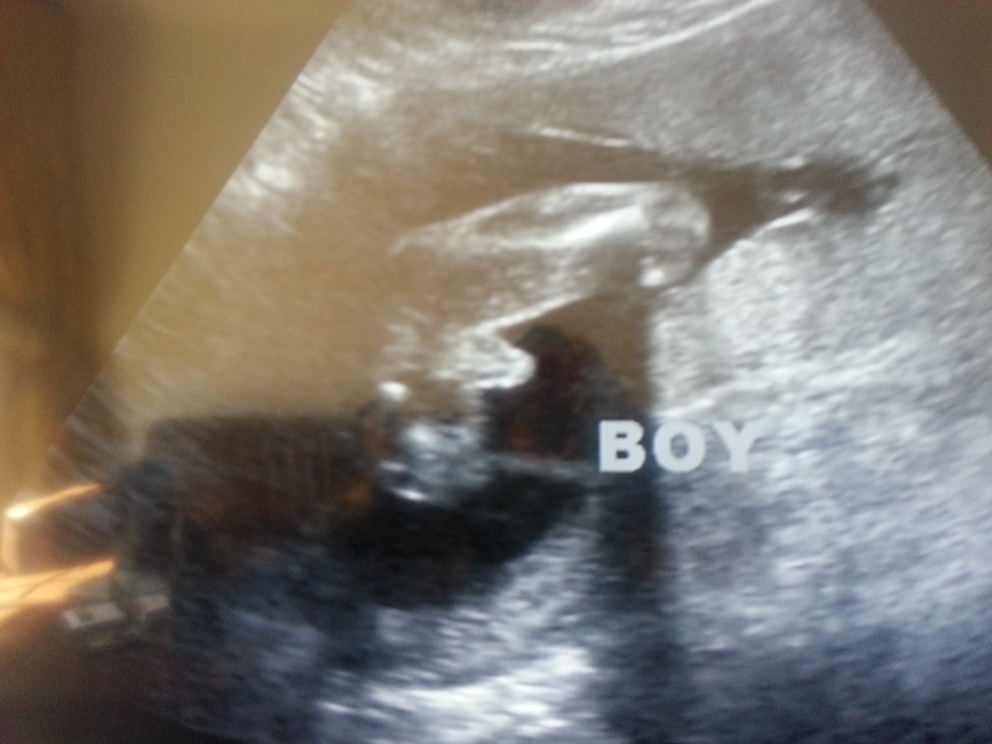 Name:  boy1.jpg
Views: 584
Size:  2.11 MB