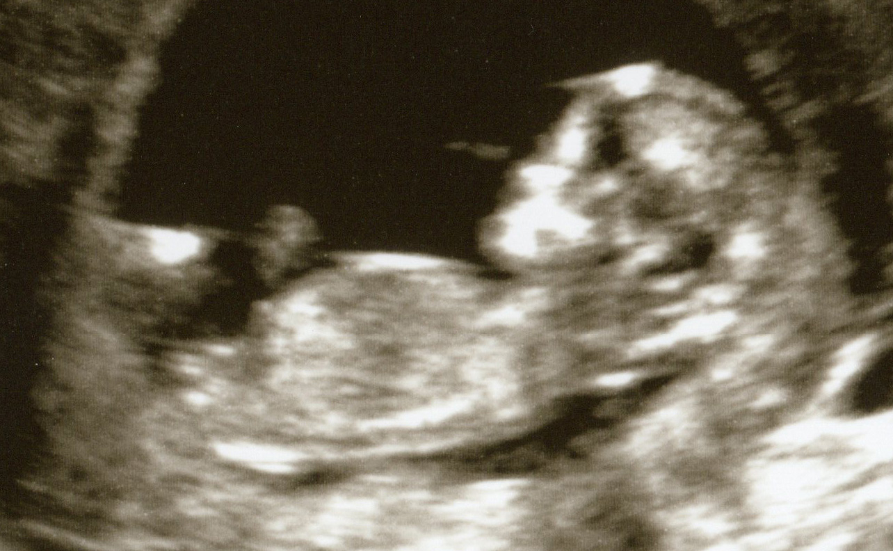 Name:  12w3dBaby5.jpg
Views: 174
Size:  324.8 KB