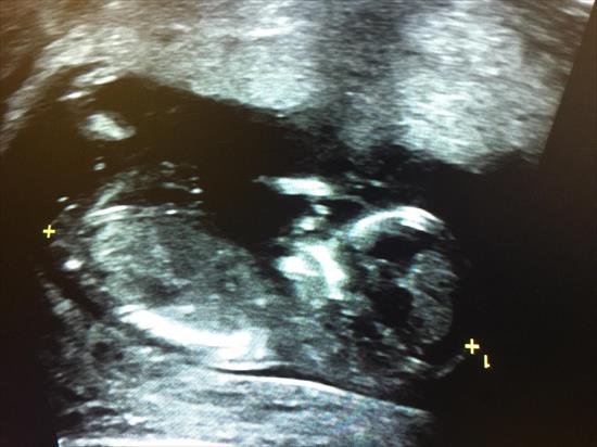 Name:  baby.jpg
Views: 347
Size:  32.4 KB