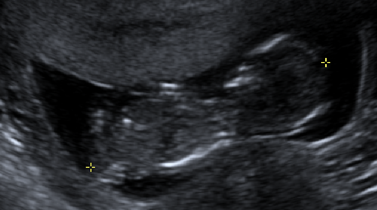 Name:  new baby 4 (2).bmp
Views: 550
Size:  898.7 KB