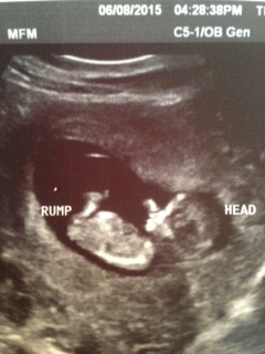 Name:  baby.jpg
Views: 508
Size:  47.6 KB