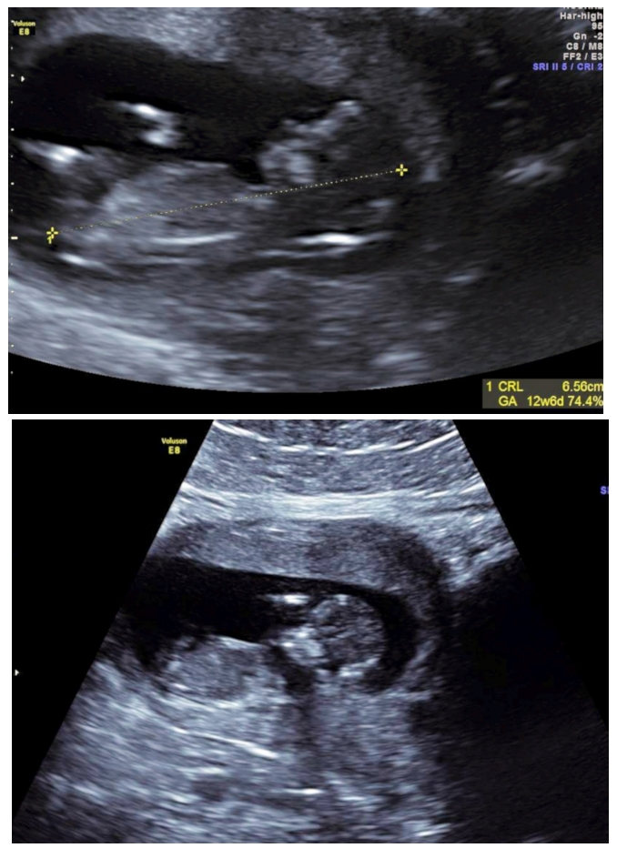 Name:  baby4yay.jpg
Views: 570
Size:  335.8 KB