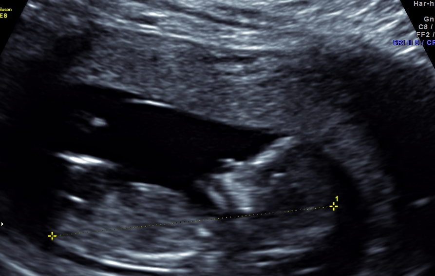 Name:  baby4aaa.jpg
Views: 772
Size:  270.4 KB