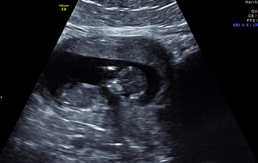Name:  babby444.jpg
Views: 502
Size:  252.2 KB