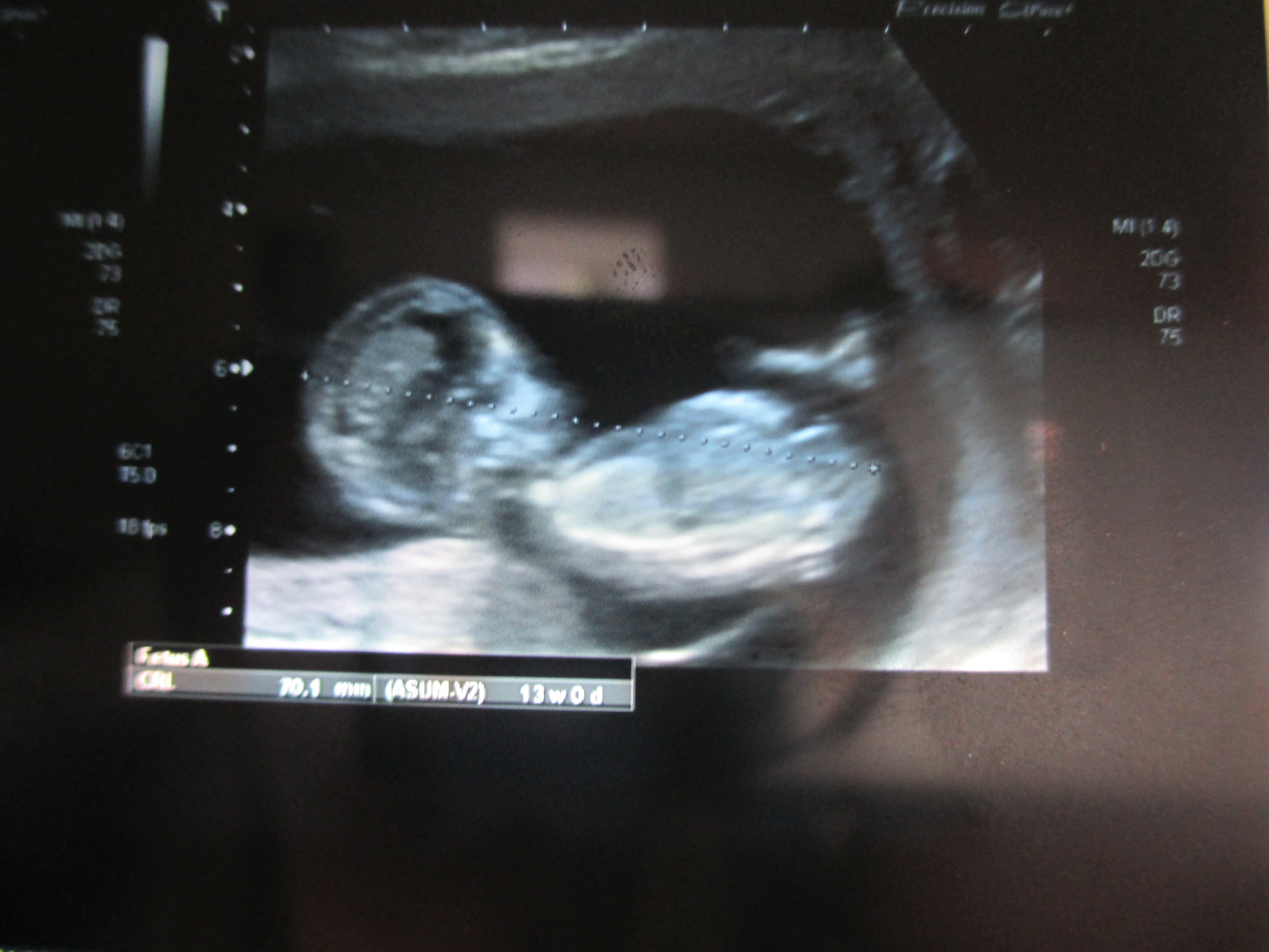 Name:  IMG_1816.JPG
Views: 841
Size:  2.25 MB