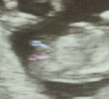 Name:  131887b119ed5e04e5c4e3e30bb3db7f.jpg
Views: 321
Size:  47.4 KB