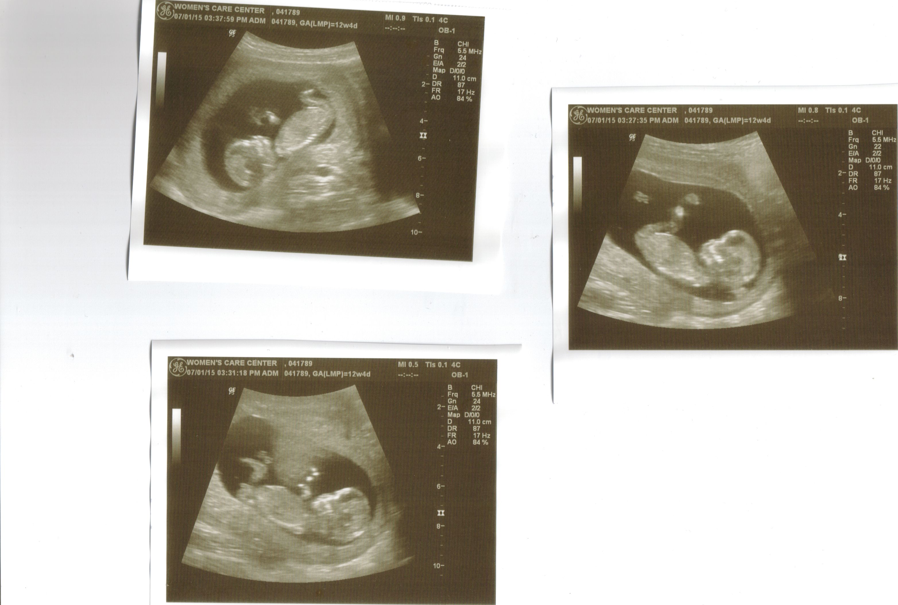 Name:  Baby#2.jpg
Views: 120
Size:  432.3 KB