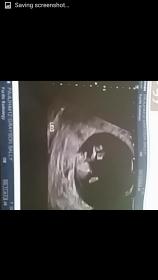 Name:  Screenshot_2015-07-03-14-15-38.jpg
Views: 154
Size:  5.0 KB