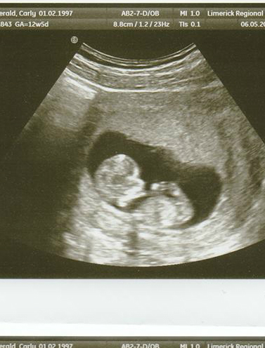 Name:  My Little cutie xxx.jpg
Views: 332
Size:  147.0 KB