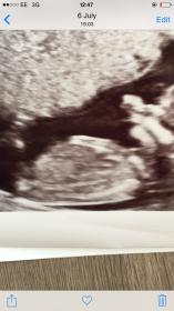 Name:  baby 2.jpg
Views: 98
Size:  8.6 KB
