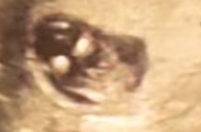 Name:  baby boy.jpg
Views: 148
Size:  10.9 KB