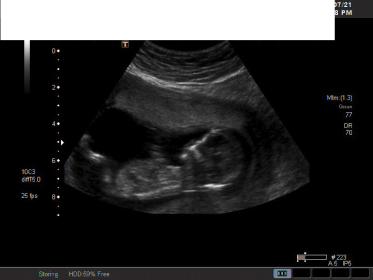Name:  nub2.jpg
Views: 398
Size:  9.8 KB