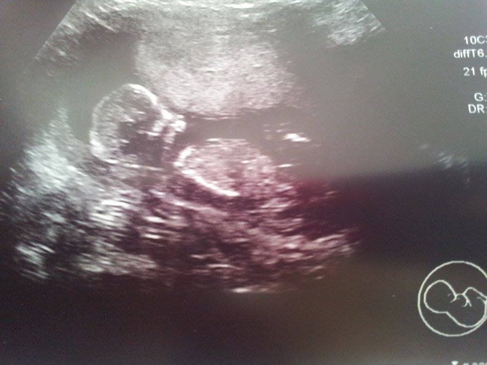 Name:  baby 2.jpg
Views: 376
Size:  67.5 KB