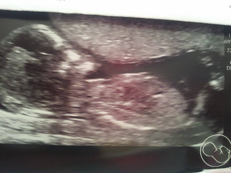 Name:  baby 7.jpg
Views: 254
Size:  68.9 KB