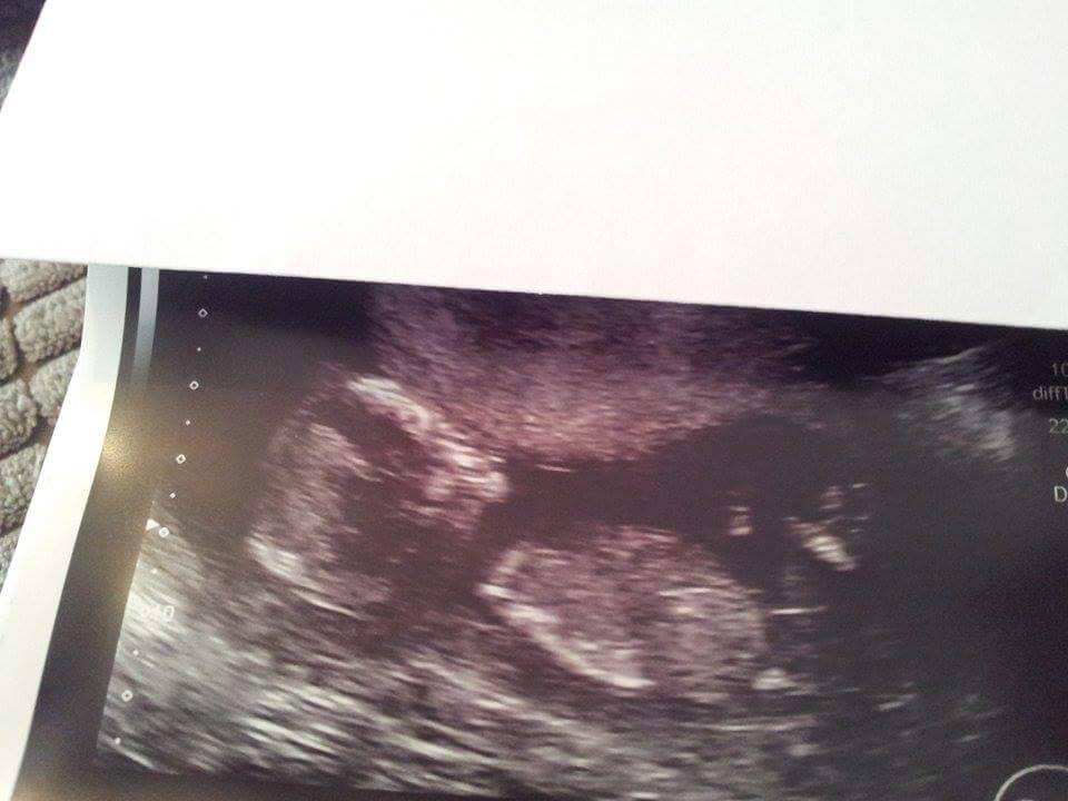 Name:  baby 9.jpg
Views: 235
Size:  54.5 KB