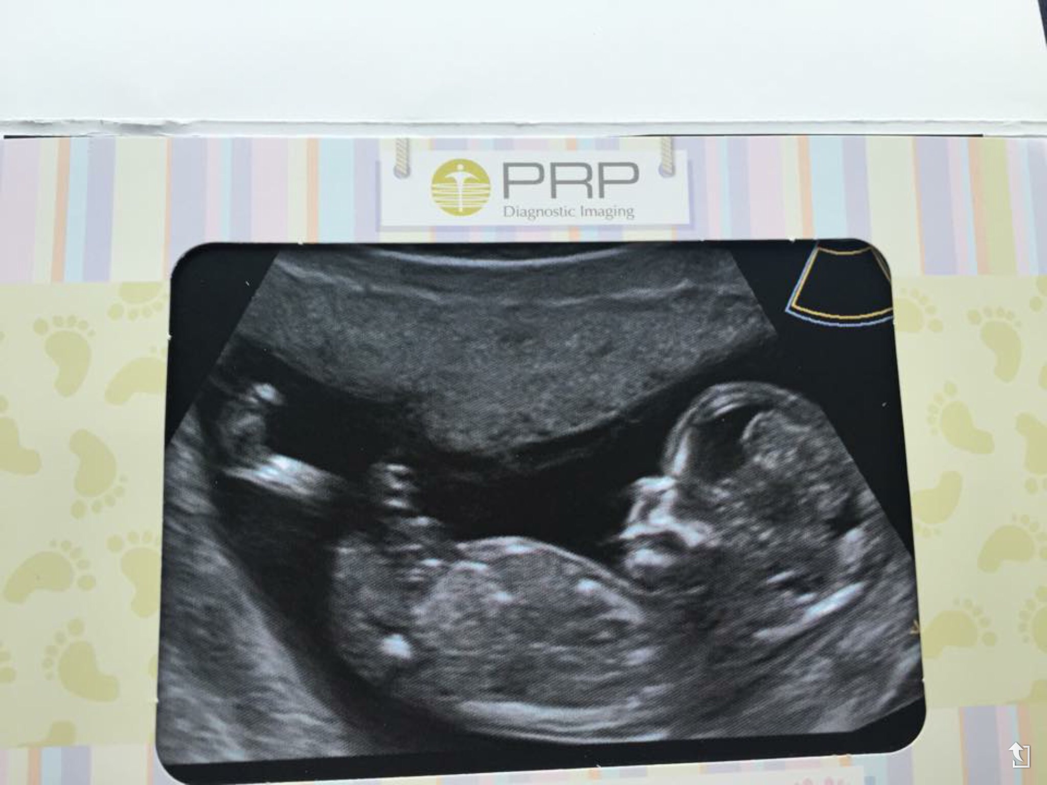 Name:  image.jpg
Views: 102
Size:  332.4 KB