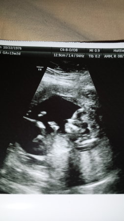 Name:  baby13weeks.jpg
Views: 181
Size:  21.9 KB