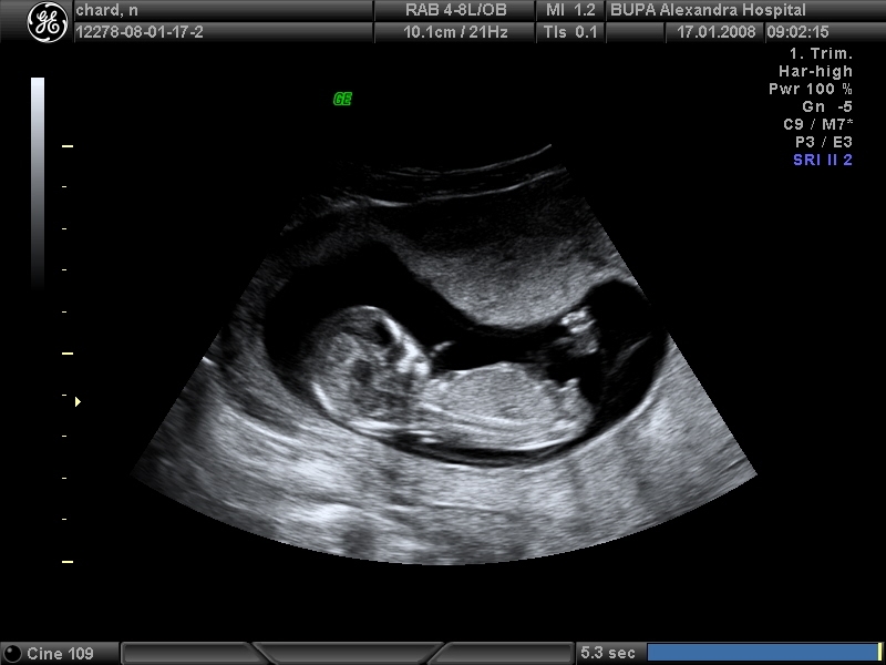 Name:  baby2.JPG
Views: 6343
Size:  157.5 KB