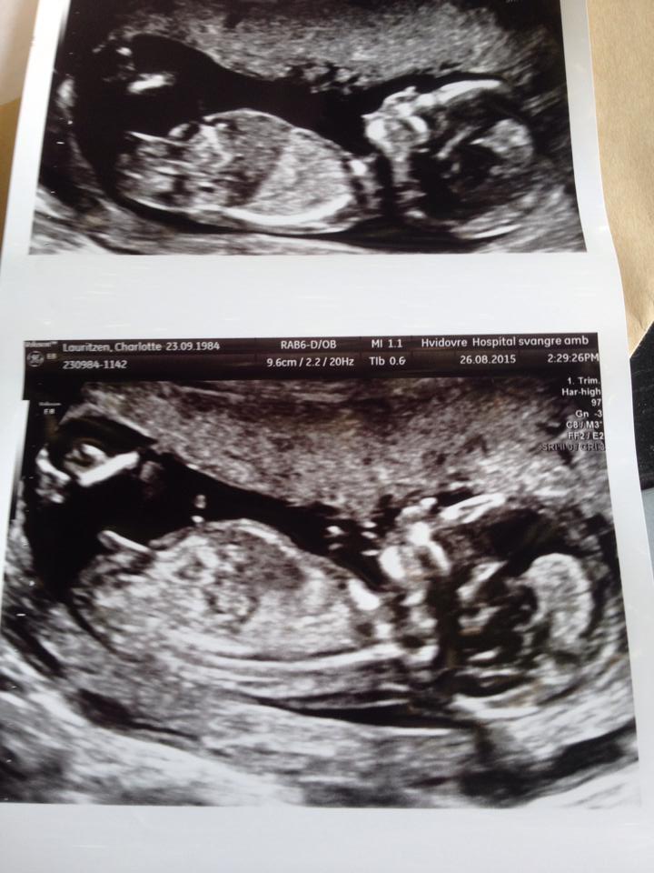 Name:  Troels baby.jpg
Views: 191
Size:  82.8 KB
