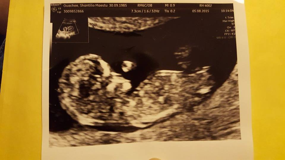 Name:  Shantiq baby.jpg
Views: 155
Size:  46.7 KB