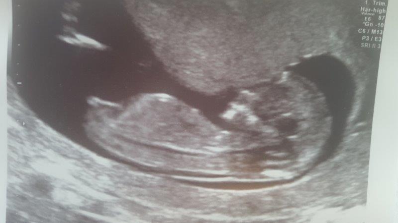 Name:  baby02.jpg
Views: 2128
Size:  33.7 KB
