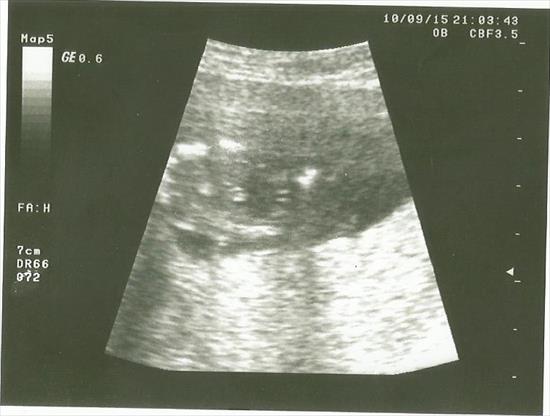 Name:  ultra2.jpg
Views: 489
Size:  26.8 KB