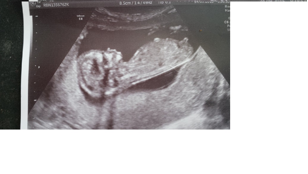 Name:  edited scan pic.jpg
Views: 206
Size:  131.7 KB