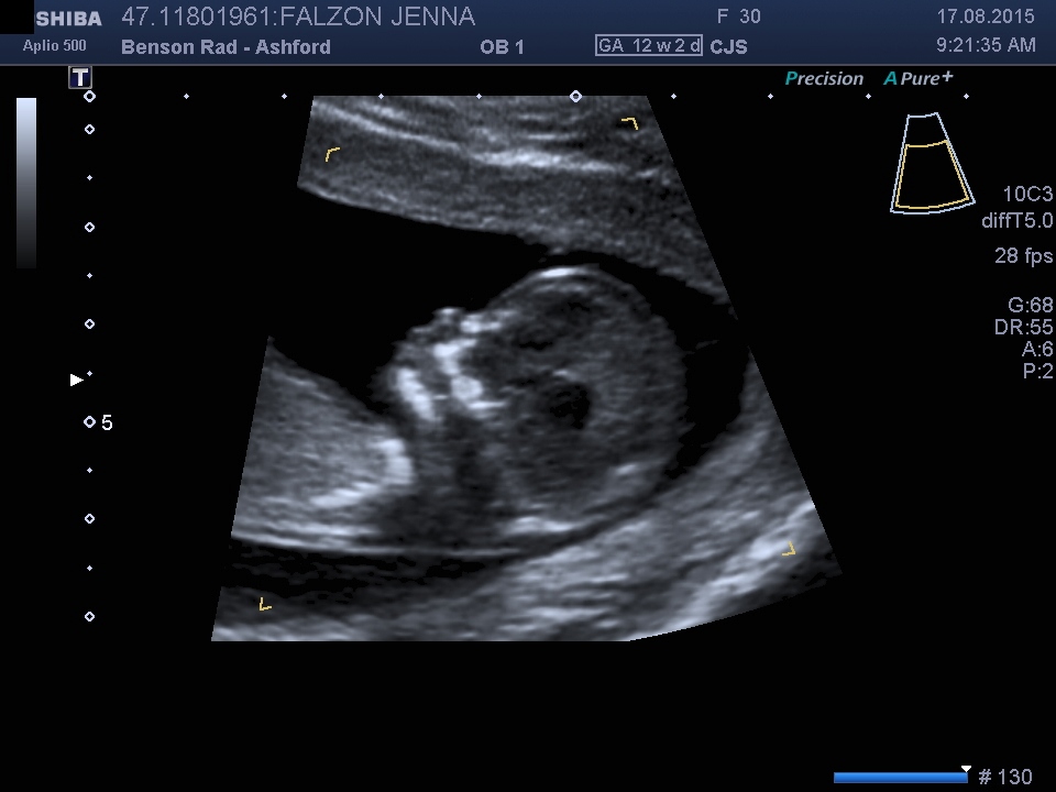 Name:  BABY_6.jpg
Views: 196
Size:  138.1 KB