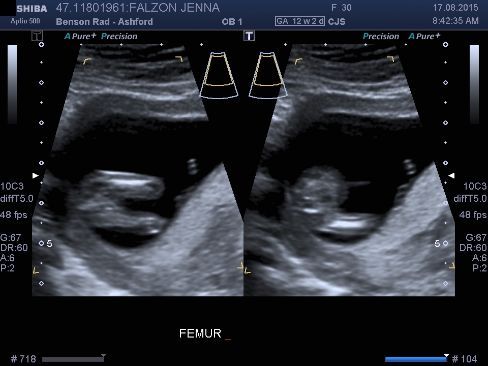 Name:  BABY_3.jpg
Views: 194
Size:  196.0 KB