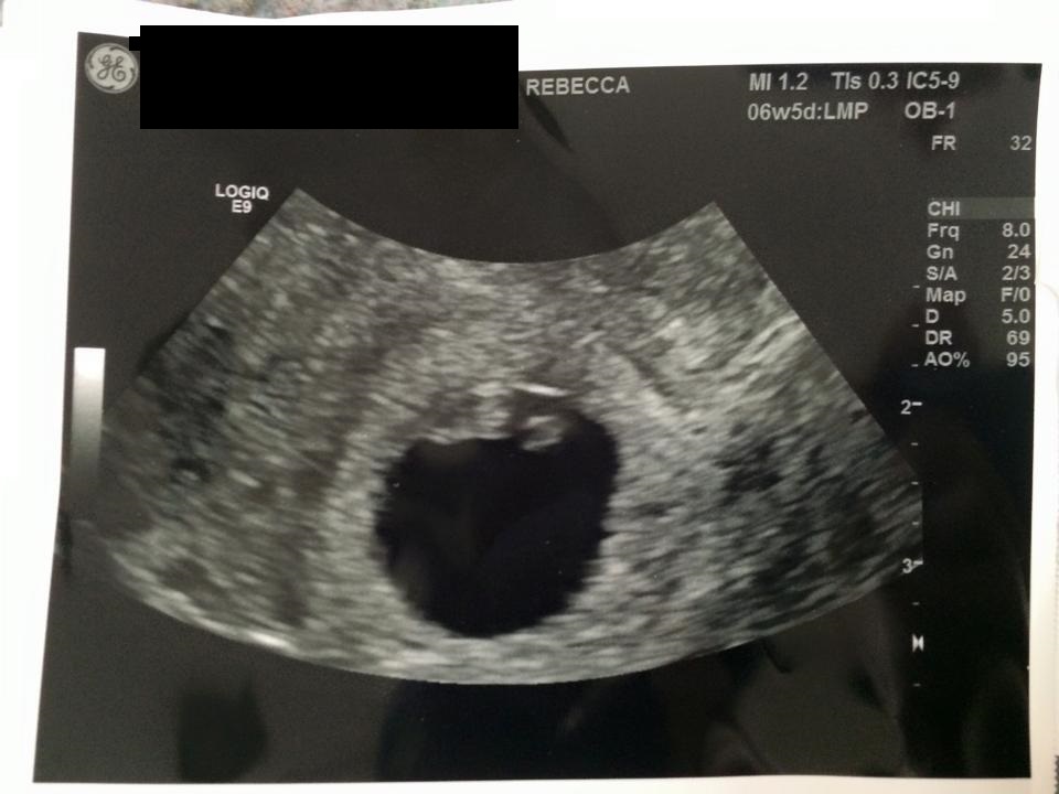 Name:  baby36w5dpic2edited.jpg
Views: 1203
Size:  108.4 KB