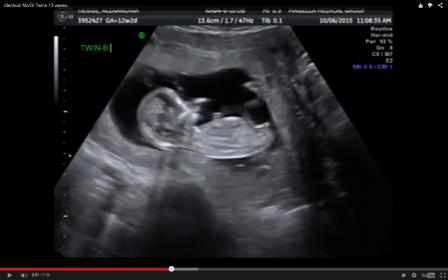 Name:  Screen Shot 2015-10-11 at 6.41.55 PM.jpg
Views: 3873
Size:  13.0 KB