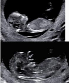 Name:  Screen Shot 2015-10-12 at 5.50.01 PM.jpg
Views: 441
Size:  10.7 KB
