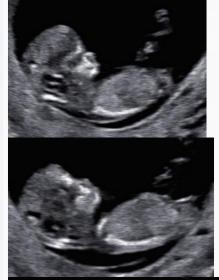 Name:  Screen Shot 2015-10-12 at 5.50.20 PM.jpg
Views: 405
Size:  9.8 KB
