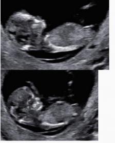 Name:  Screen Shot 2015-10-12 at 5.50.28 PM.jpg
Views: 443
Size:  10.5 KB