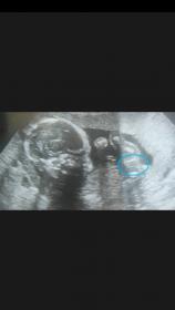 Name:  Screenshot_2015-10-25-13-19-45.jpg
Views: 265
Size:  4.3 KB