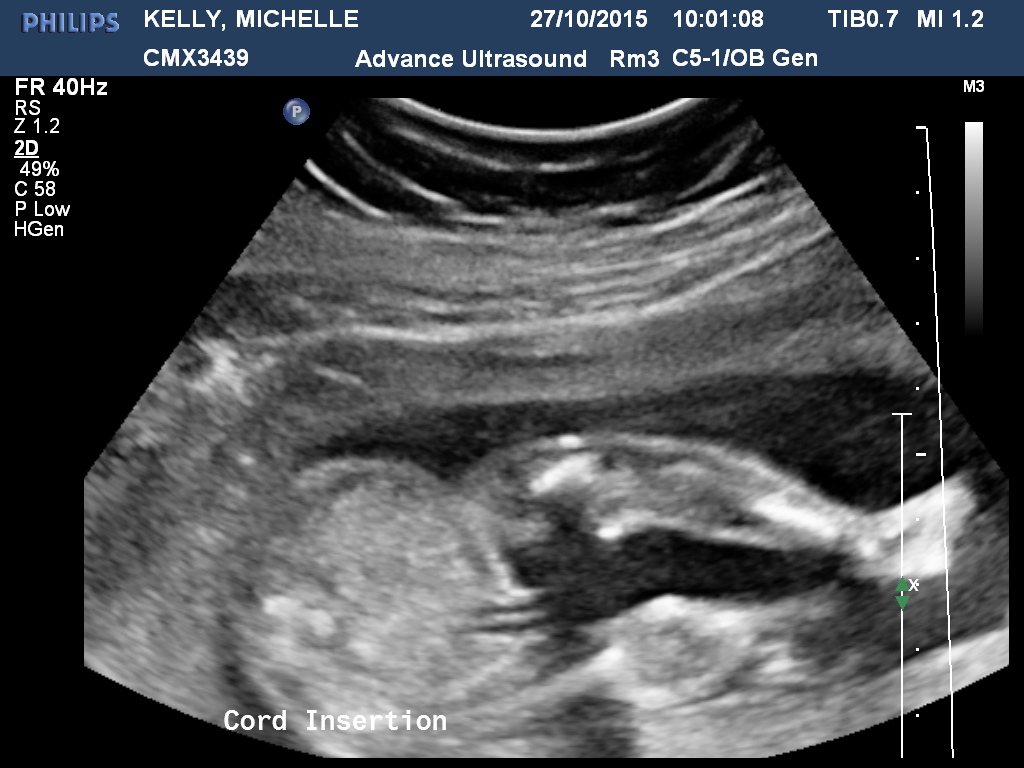 Name:  KELLYMICHELLE20151027100109166.jpg
Views: 864
Size:  198.7 KB