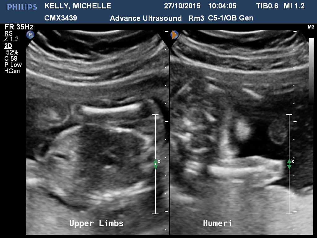 Name:  KELLYMICHELLE20151027100406844.jpg
Views: 491
Size:  228.1 KB