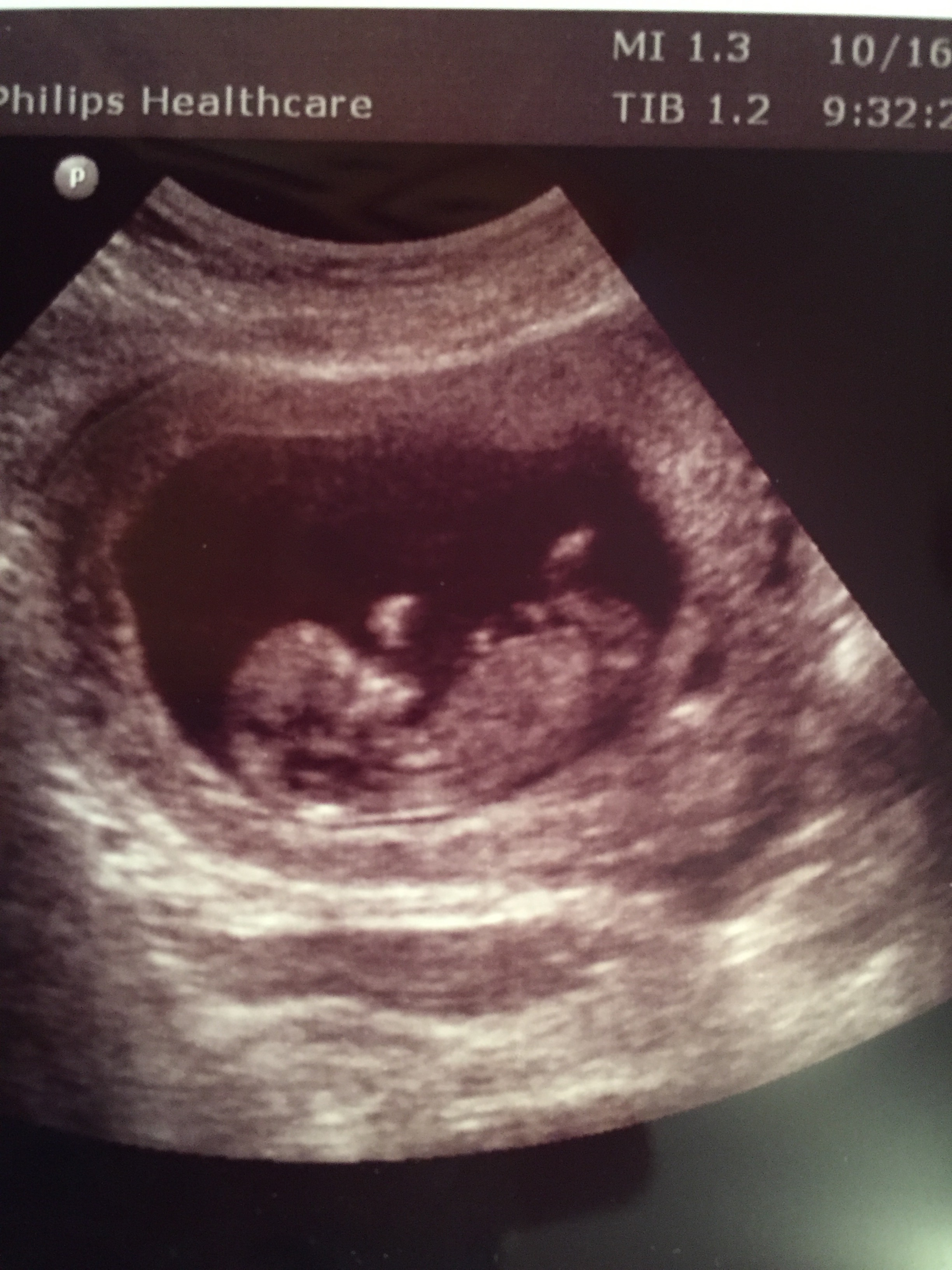Name:  baby4.jpg
Views: 768
Size:  1.27 MB