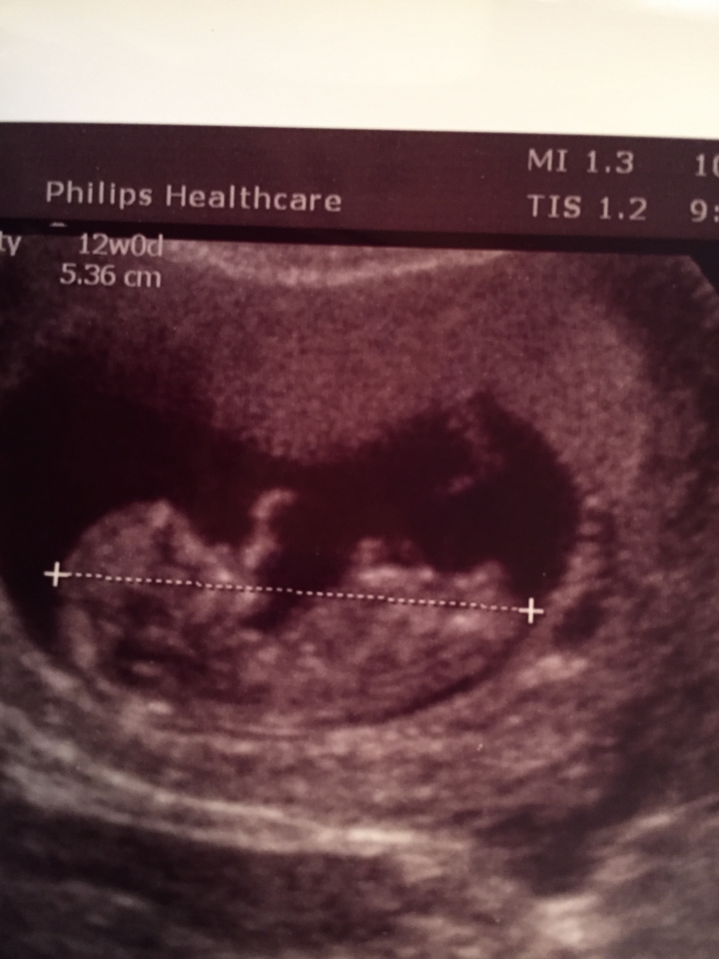Name:  baby1.jpg
Views: 1327
Size:  1.08 MB