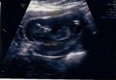 Name:  12W-Gest sac.jpg
Views: 112
Size:  11.9 KB