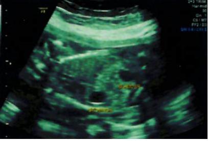 Name:  20W-Bladder.jpg
Views: 135
Size:  15.0 KB