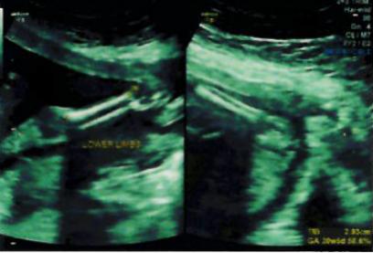 Name:  20W-Lower limbs.jpg
Views: 133
Size:  17.7 KB