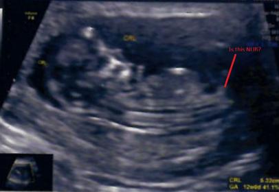 Name:  12W-nub marked.jpg
Views: 107
Size:  14.1 KB