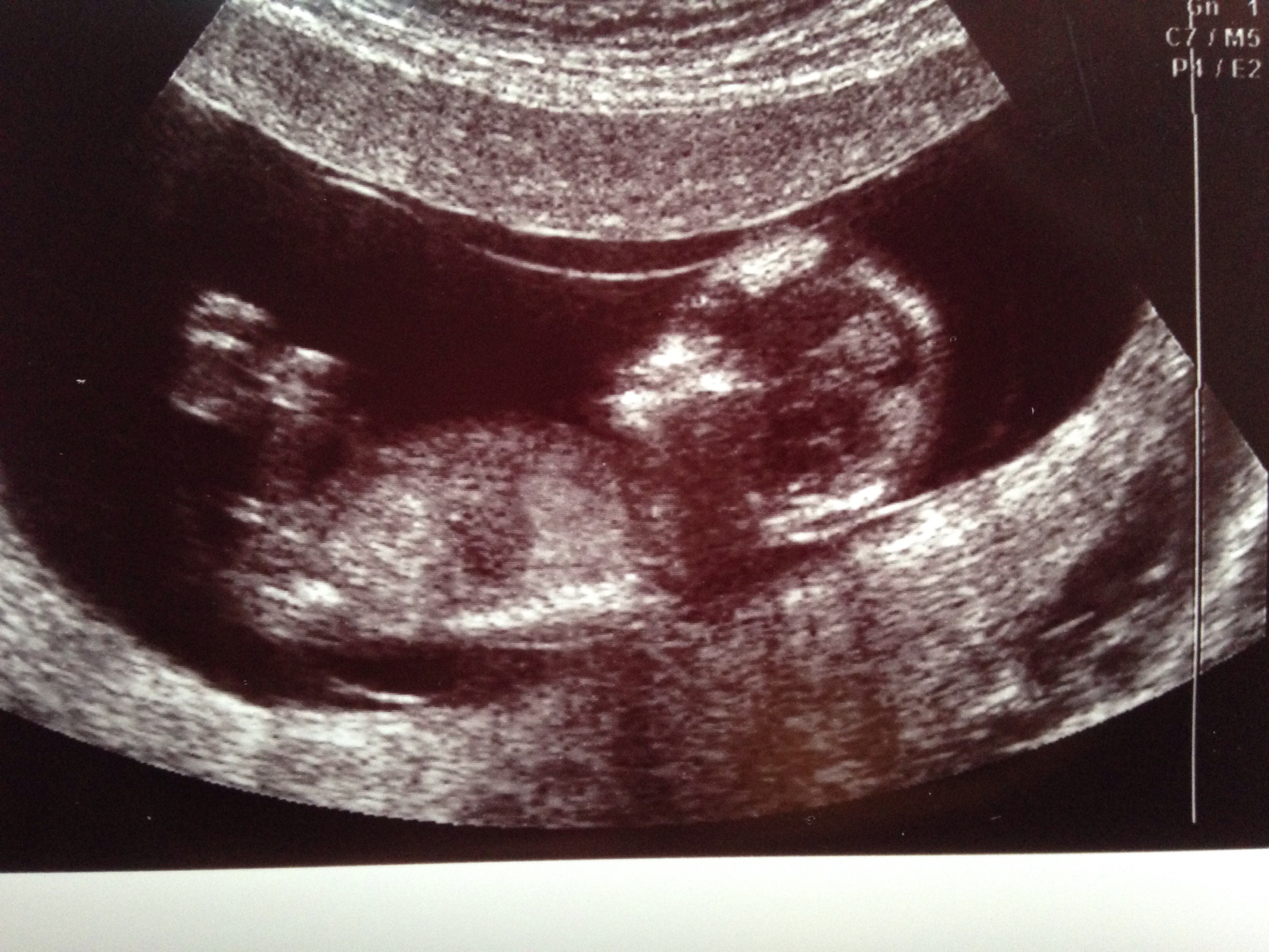 Name:  scan 1.jpg
Views: 195
Size:  1.75 MB