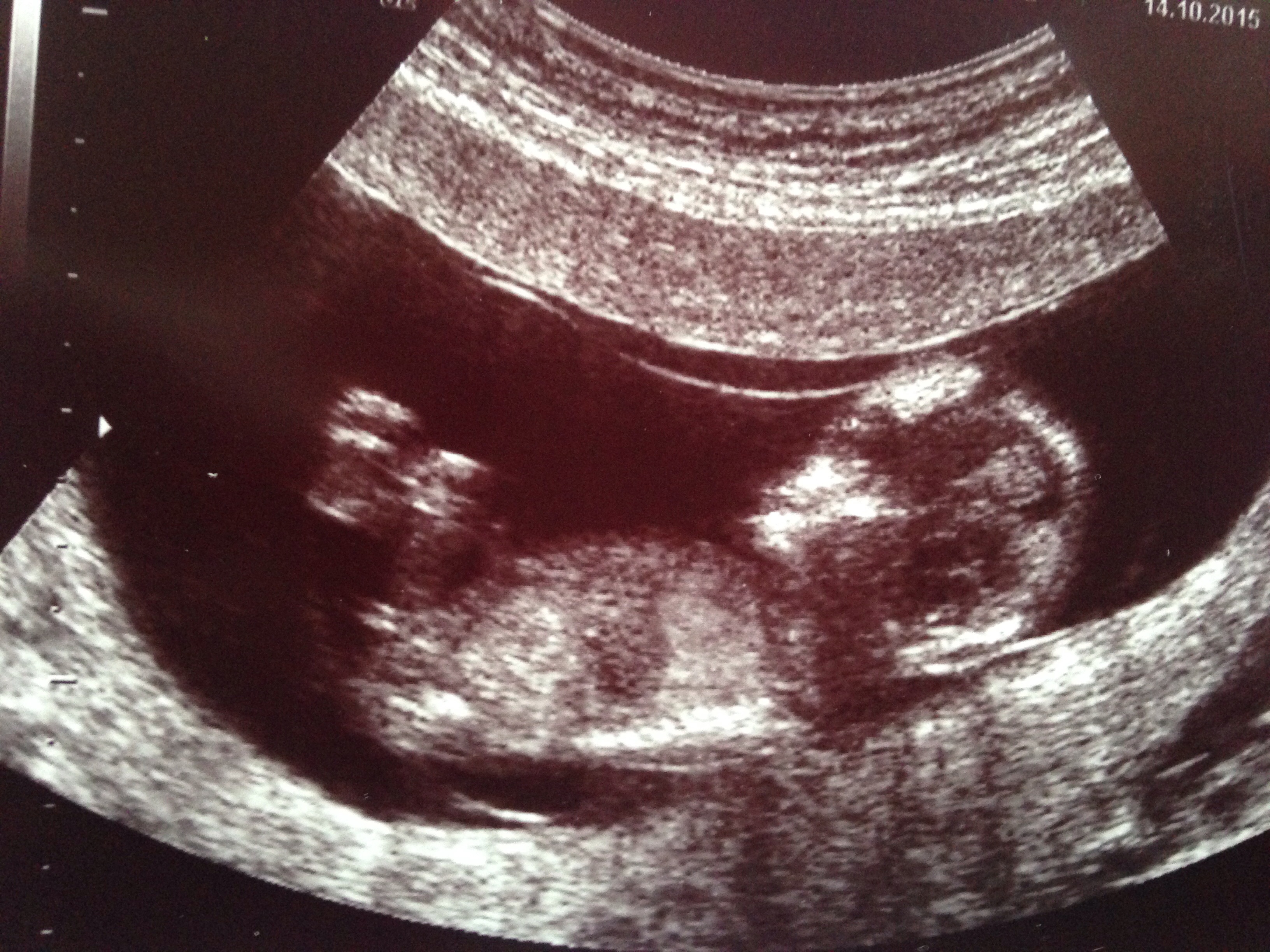 Name:  scan 2.jpg
Views: 197
Size:  1.95 MB