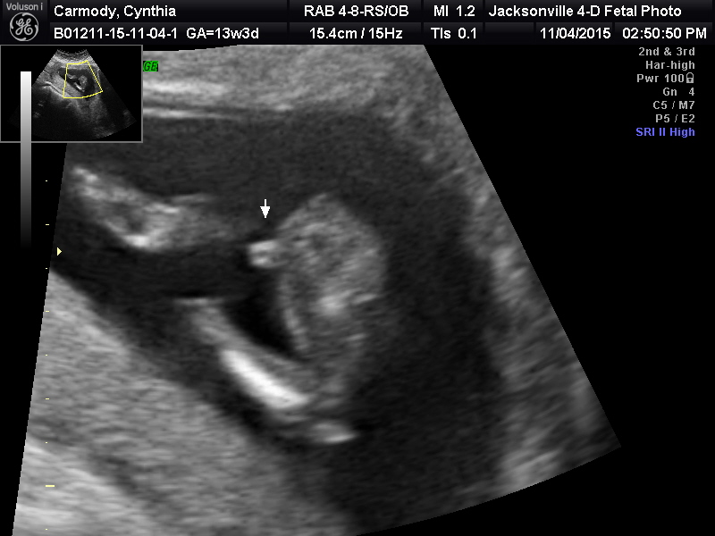 Name:  BABY_24.JPG
Views: 2113
Size:  123.3 KB